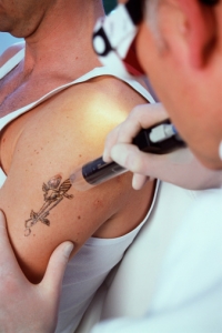 tattooremovaljudithcrowellmddermatologistmiami